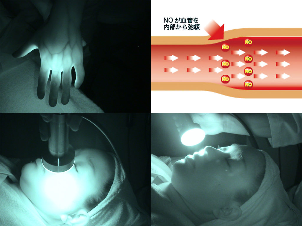 近赤外線の効果や照射の様子